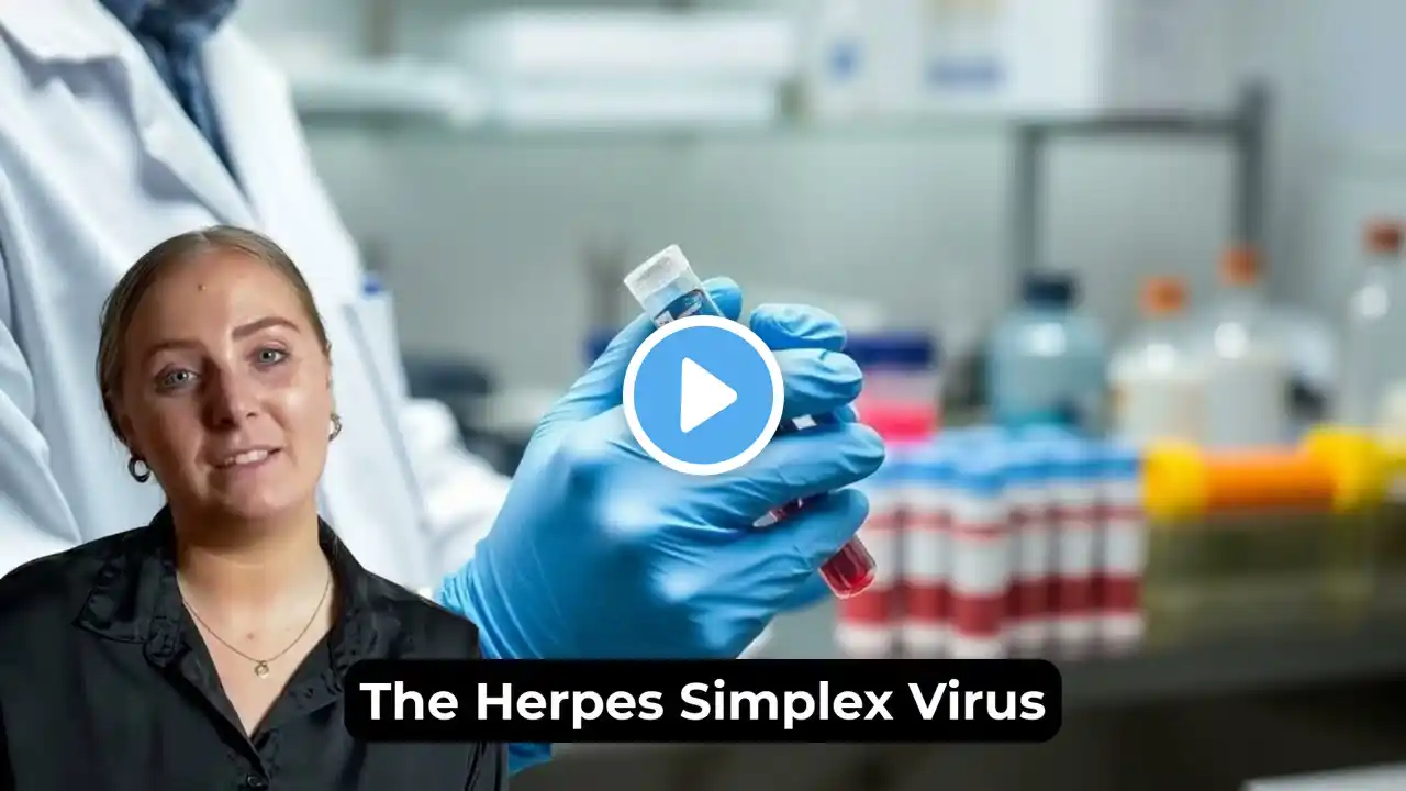 Herpes Simplex Virus HSV II, IgG Test