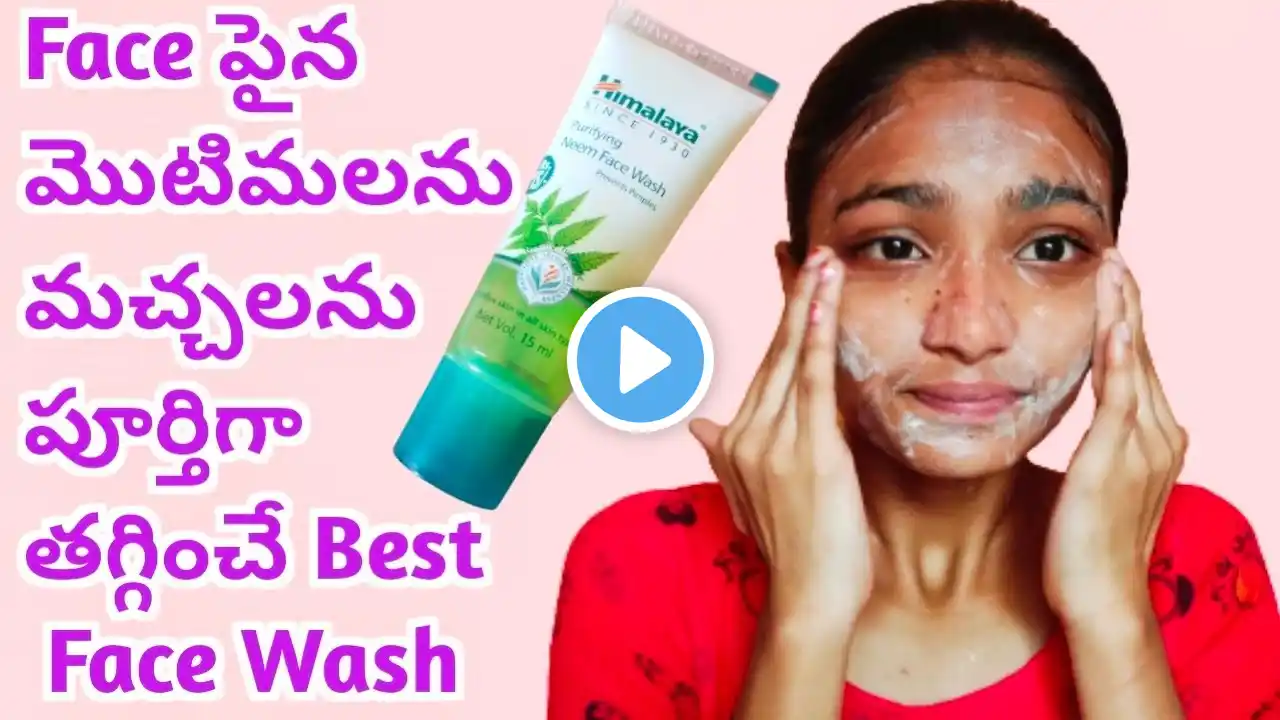 మొటిమలను, మచ్చలను తగ్గించే Best Face Wash....Himalaya Purifying Neem Face Wash