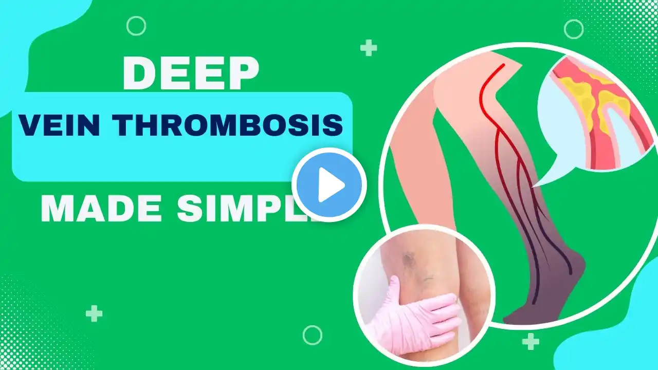 ALL YOU NEED TO KNOW ABOUT DEEP VEIN THRUMBOSIS/THE HIDDEN DANGER IN YOUR LEGS