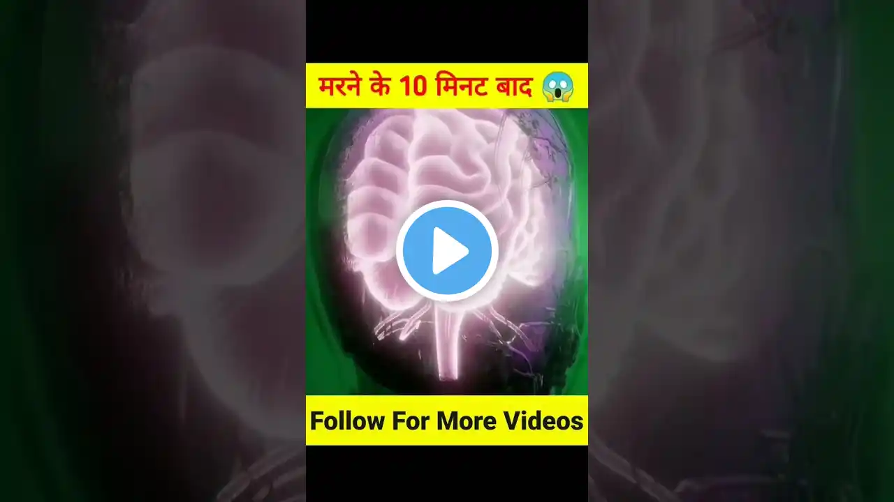 मरने के 10 मिनट बाद😪#comdey #funny#shorts #subscribe #viral #shortvideo #short #status #silverboy
