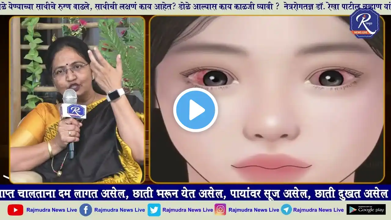 डोळे येणे म्हणजे काय? कारणे, लक्षणे, उपाय उपचार? Eye Conjunctivitis? Causes, signs Symptms?dole yene