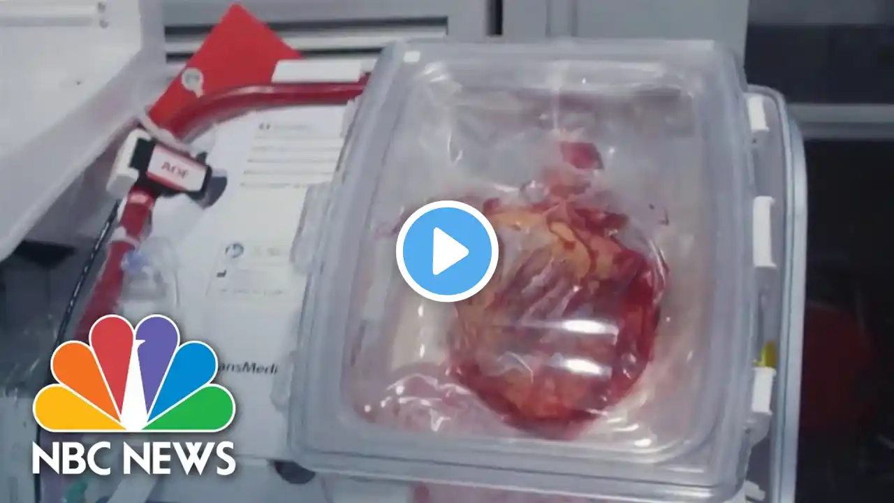 How 'heart in a box' technology could help heart transplant recipients 