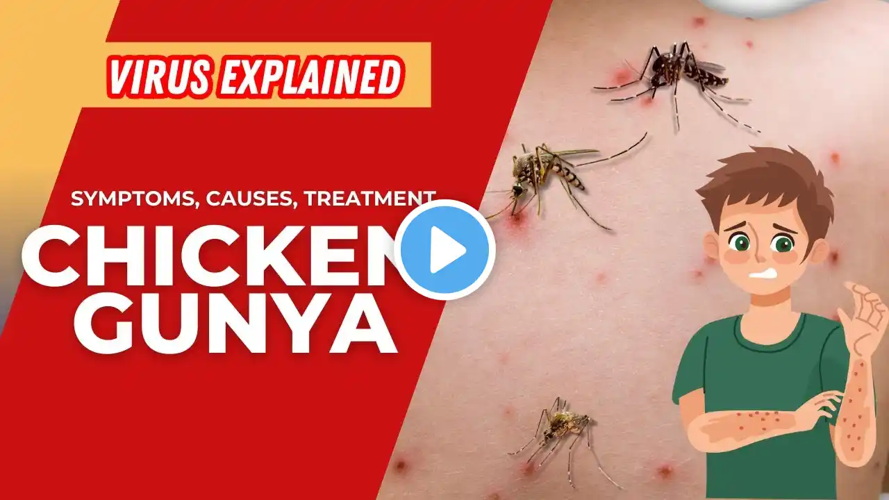 Chikungunya Virus Infection: Symptoms and Treatment Explained #infectionprevention