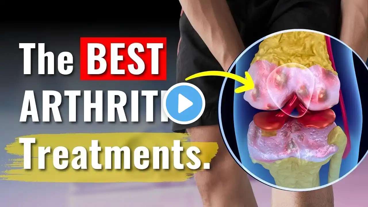 Knee Arthritis Treatments Proven to Work - The Truth You Need to Know