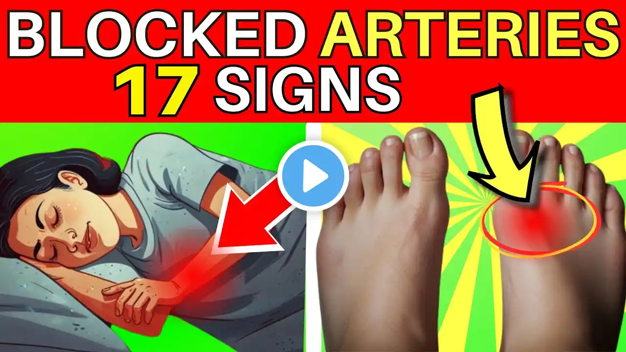 17 Early Warning Signs Of Clogged Arteries In Your Legs and Feet You Should Lookout For