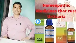 Urticaria/पित्ती Homeopathic Medicines for urticaria! होम्योपैथिक मेडिसिन से पित्ती तुरन्त ठीक करें!