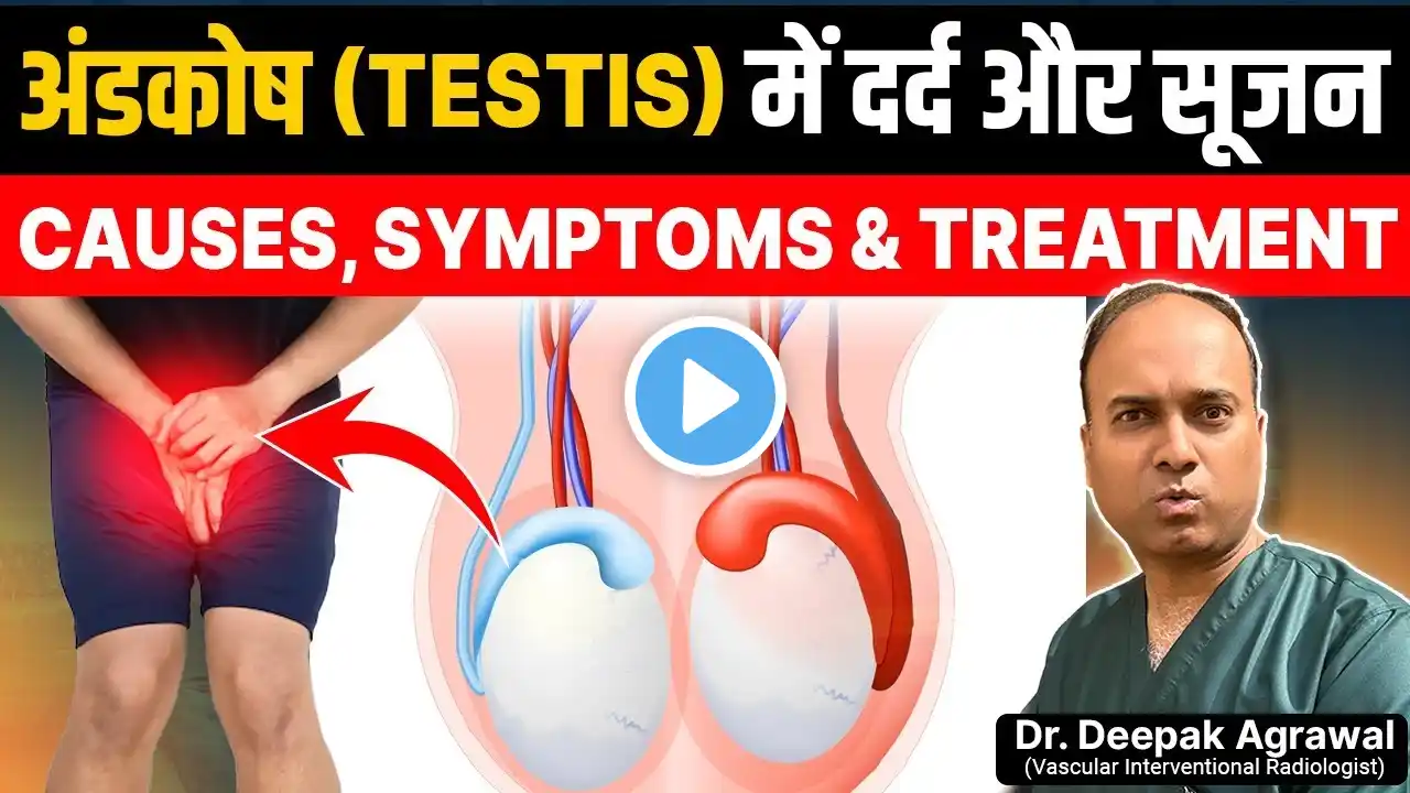 Andkosh Me Dard, Sujan aur Ganth ka ilaj | Testis Pain Treatment & Causes in Hindi