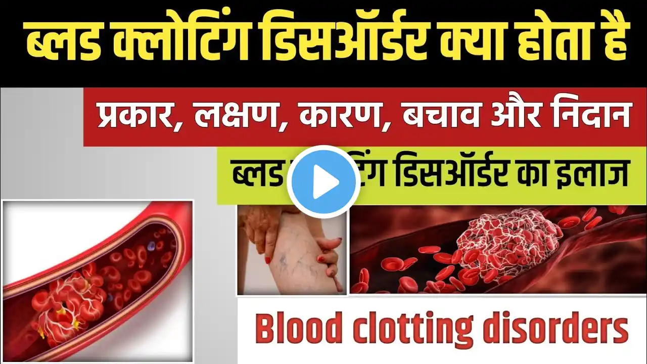 ब्लड क्लोटिंग डिसऑर्डर के लक्षण, कारण और इलाज || Blood clotting disorders in hindi