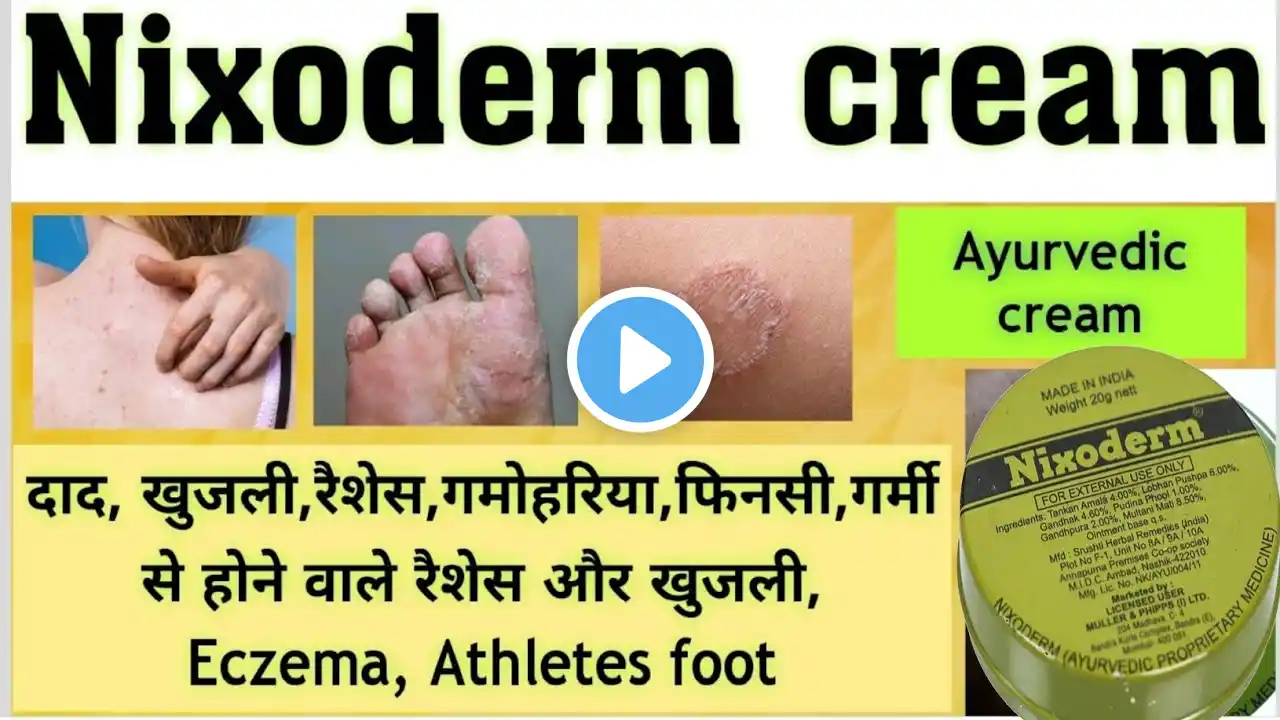 दाद खाज खुजली की बेस्ट दवा || Best Medicine For Fungal Infections || Nixoderm cream