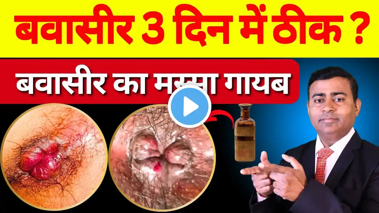 क्या बवासीर ३  दिन में ठीक हो सकता है ? बवासीर की दवा #pilestreatment #fissuretreatment