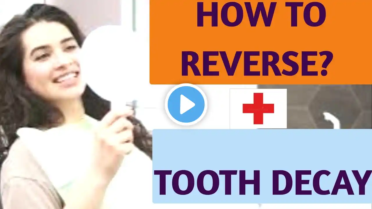 Cavity natural home remedies English |  | tooth decay prevention |  #tootherosion #cavityprevention