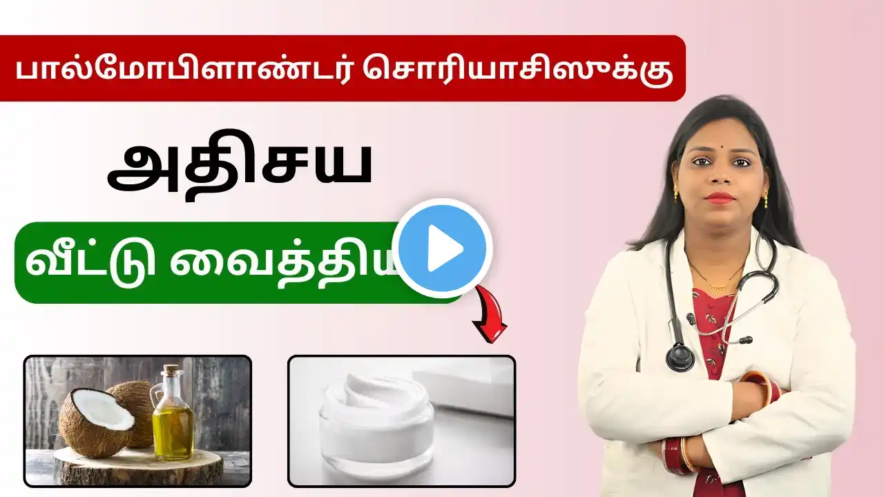 பால்மோபிளாண்டர் சொரியாசிஸுக்கு அதிசய வீட்டு வைத்தியம் | How to Cure Palmoplantar Psoriasis in Tamil