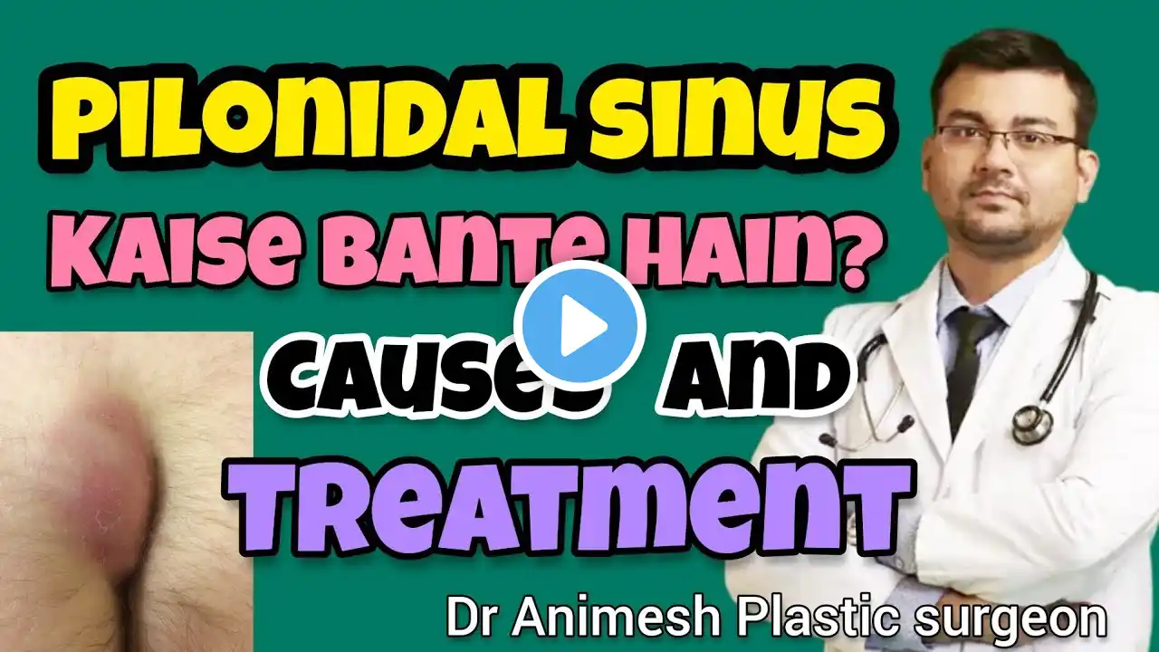 Pilonidal sinus क्या है? कैसे बनता है? इसमें cancer तो नहीं होता? इलाज़ कैसे और कहां करे? Dr Animesh