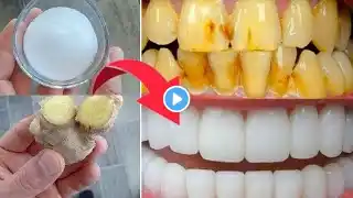 Natural mixtures for yellow whitening at home in 2 minutes without a dentist, a proven method🦷