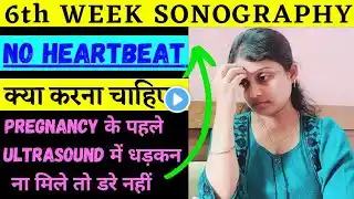 🤰NO HEARTBEAT in 1st Ultrasound~Pregnancy 5 to 8 Week🤰Pregnancy Story Hindi~Early pregnancy symptoms