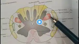 Transverse section of medulla oblongata/ pyramidal decussation/ lower closed part of medulla