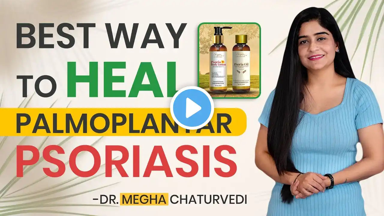 How to Treat Palmoplantar Psoriasis at Home | Best Way to Heal Palmoplantar Psoriasis