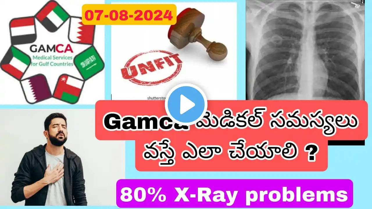 GAMCA Medical Problems How to slove Telugu 07-08-2024 || Gulf News Telugu || X-ray problem