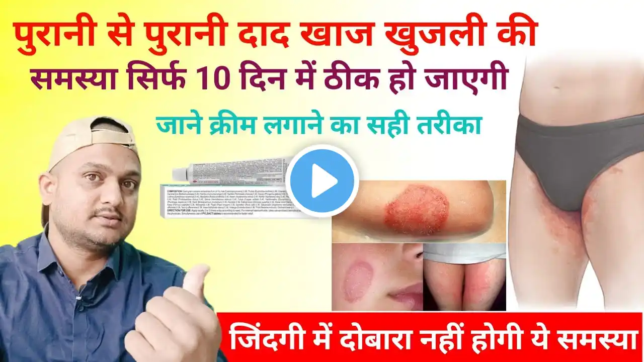 ये दवा केवल 7 दिन में दाद खाज खुजली की समस्या को जड़ से ख़तम कर देगी | Private part itching | fourderm