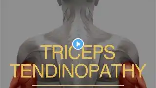 Understanding Triceps Tendinopathy 💪🔥 #physicaltherapy #shorts