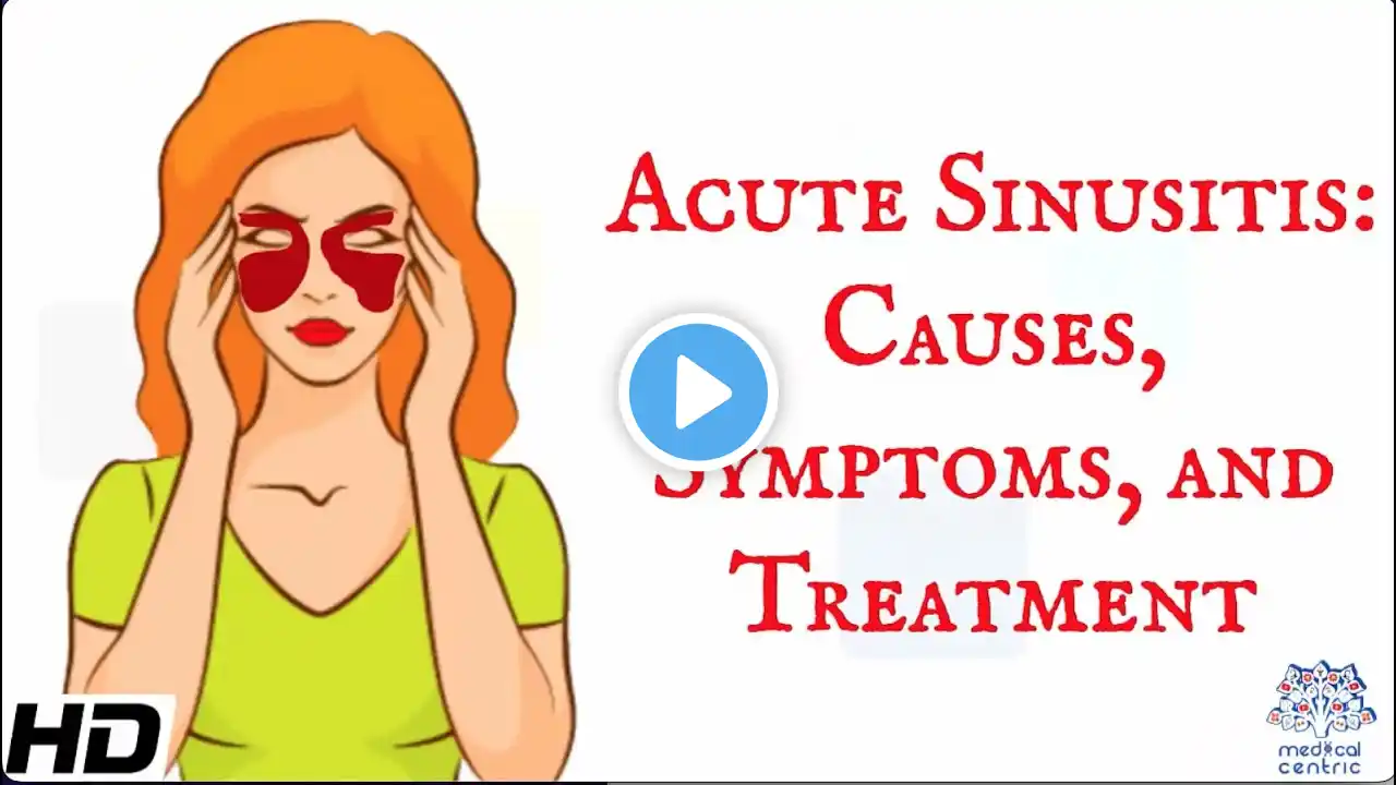 Acute sinusitis : Everything you need to know