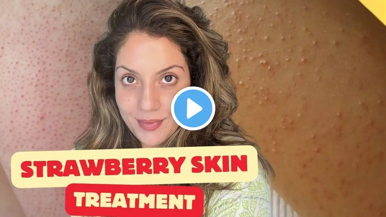 Strawberry Skin Treatment | Keratosis Pilaris Treatment at Home | Top body shaving mistakes