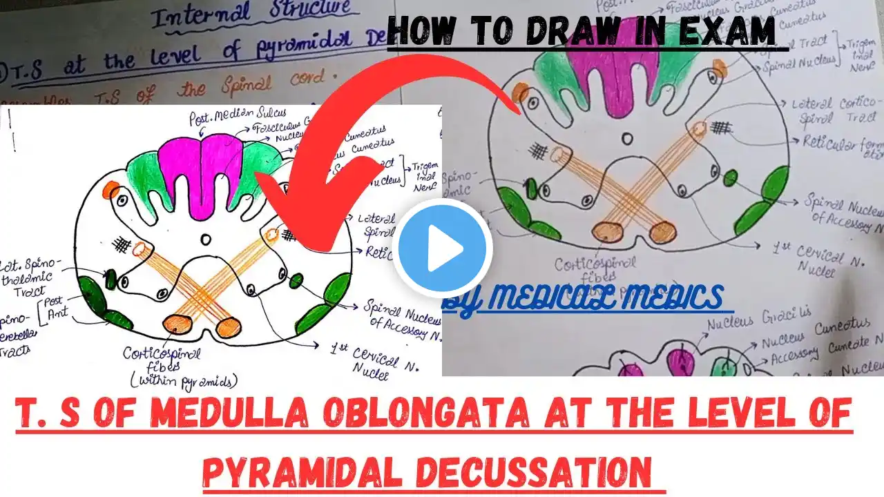 Transverse Section of Medulla - 1 | T.S of Lower Part of Medulla at Pyramidal Decussation