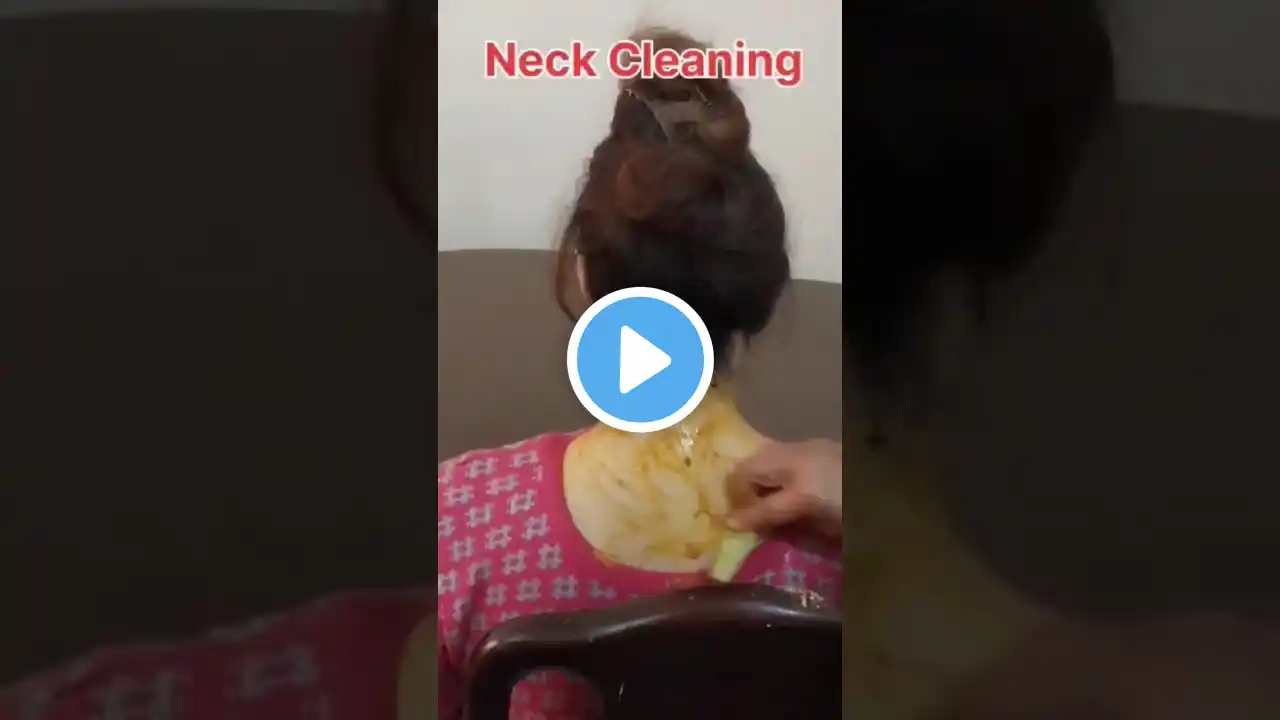 Neck Cleaning tips /  Get rid of dark neck || #shorts #youtubeshorts #viral #viralvideo #tanremove