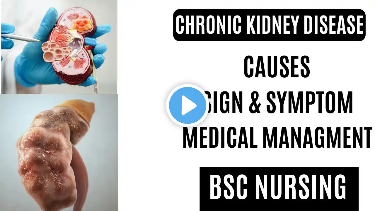 Define Chronic kidney disease | clinical manifestation and medical management |nursing lecture