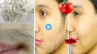 Stop shaving ! Painless removal of facial , body and pubic hair