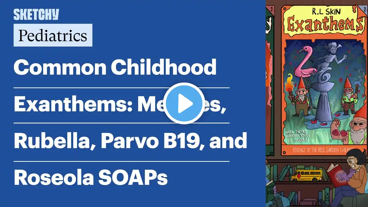 Common Childhood Exanthems: Measles, Rubella, Parvo B19, and Roseola SOAPs (Pediatrics) | Sketchy