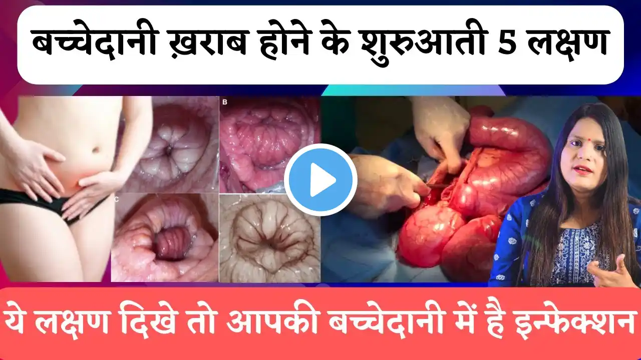 Bachedani me dard kyu hota hai | Pain in uterus area in hindi | Bachedani me dard ho to kya kare