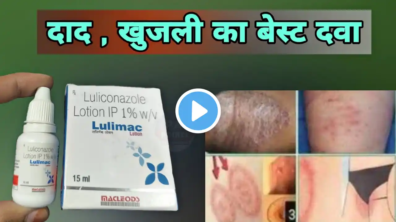 luliconazole lotion | fungal infection | lulimac lotion uses in hindi | daad khaj khujli ka cream