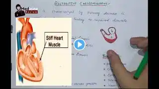 Restrictive cardiomyopathy | pathology | cardiovascular system | heart |English | Medicine review