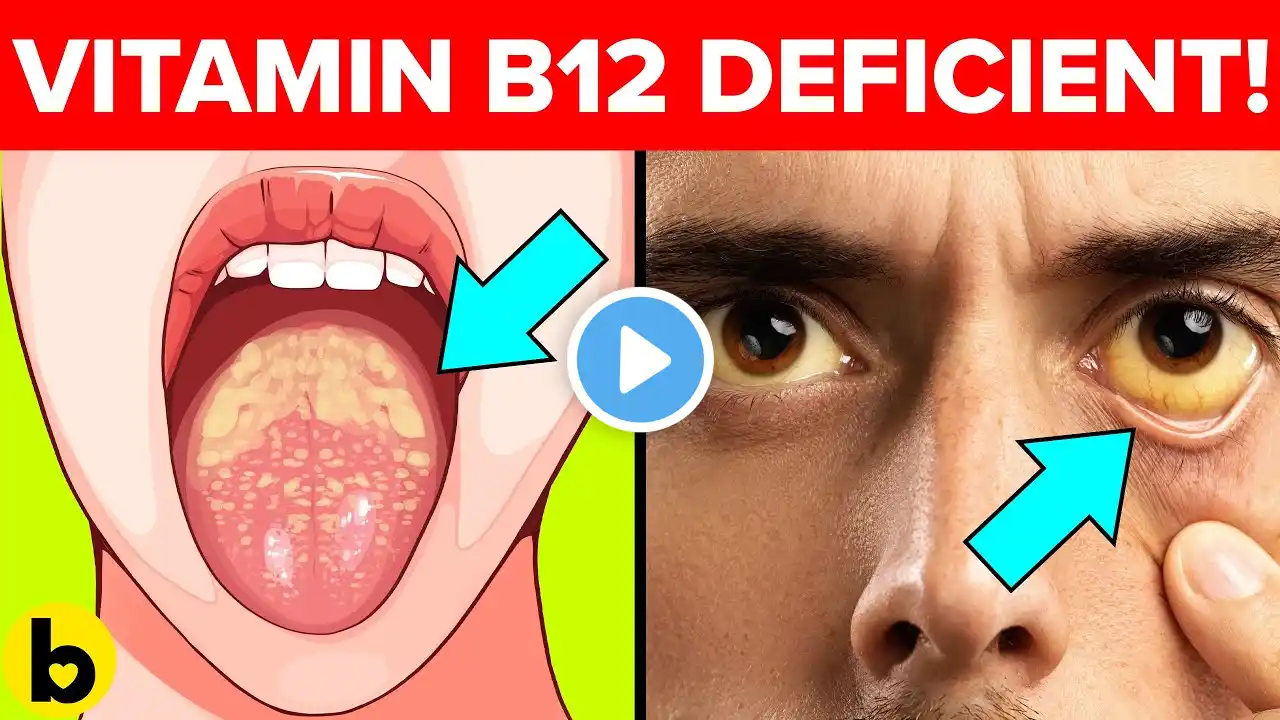 9 Warning Signs That Your Body Is Low On Vitamin B12