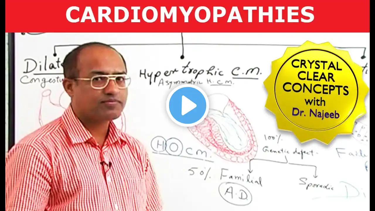 Cardiomyopathy Causes & Symptoms | Cardiology🫀