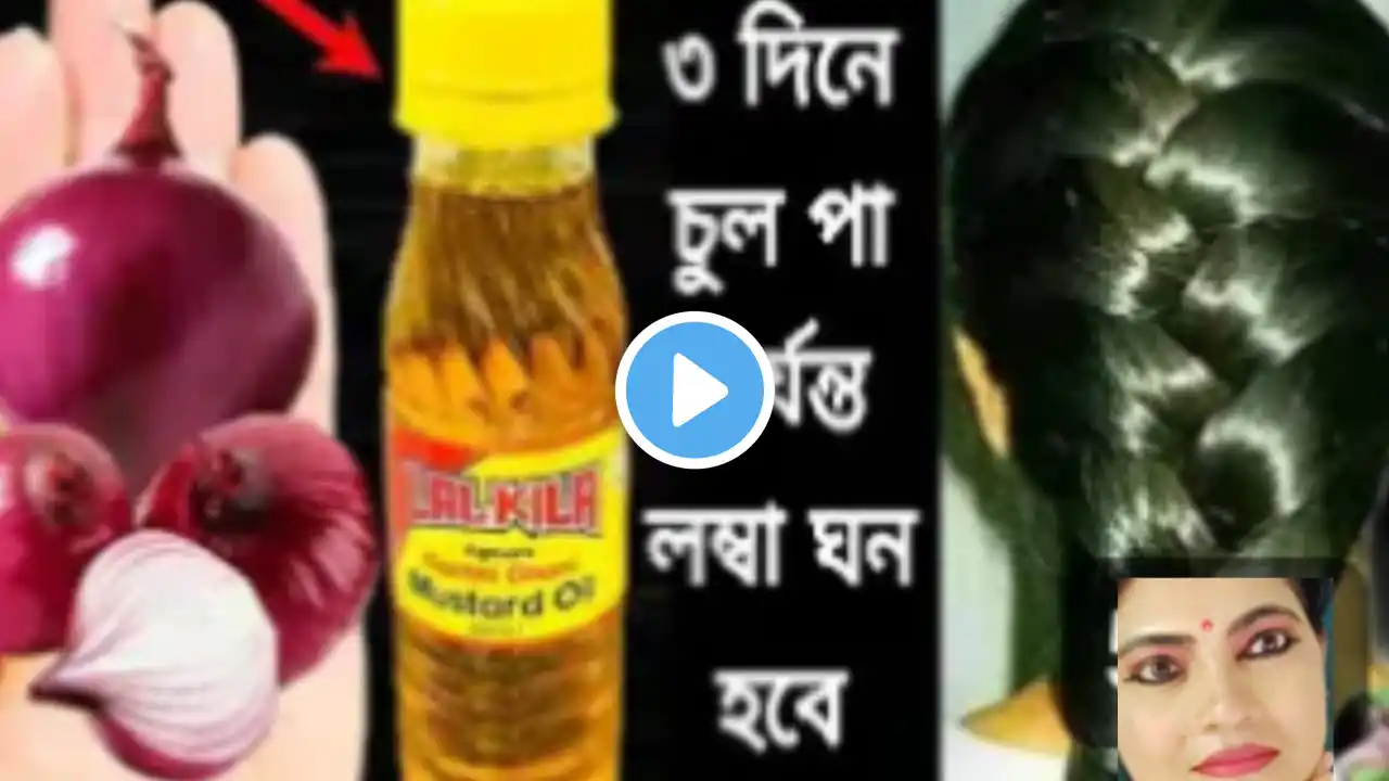 ৩ দিন এটা লাগাও চুল পা পর্যন্ত লম্বা ও হবে চুল ঘন কালো হবে নতুন চুল গজাবে/hair growth remedies