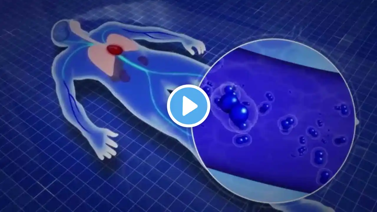 HBOT for Urologists - Healing Radiation Injury with Hyperbaric Oxygen Therapy