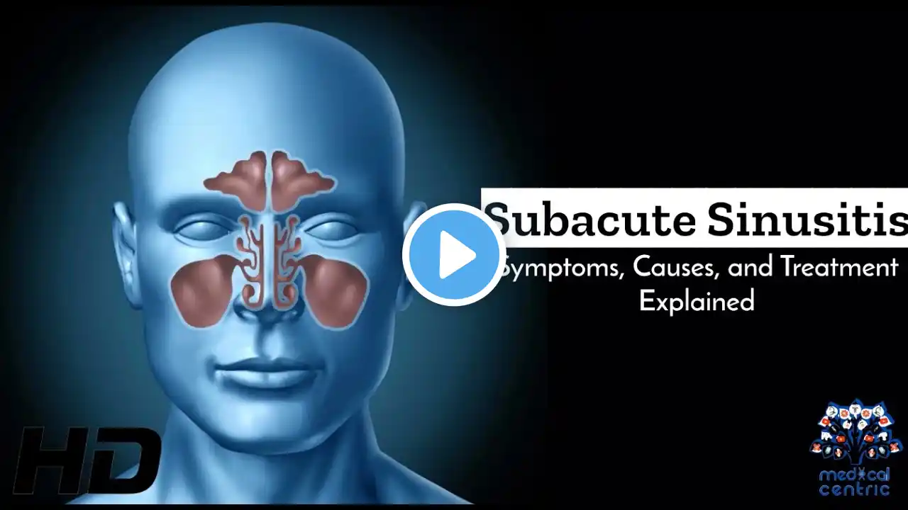 Subacute Sinusitis - Causes and Remedies