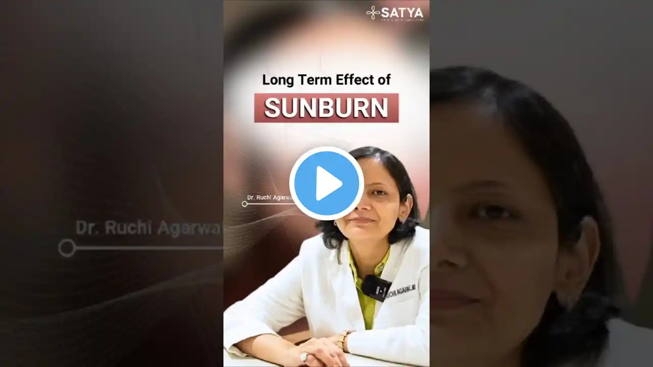 Is Sunburn causing long term damage to your skin?🌴☀️#skincare #skincareroutine #sunscreen #sun #goa