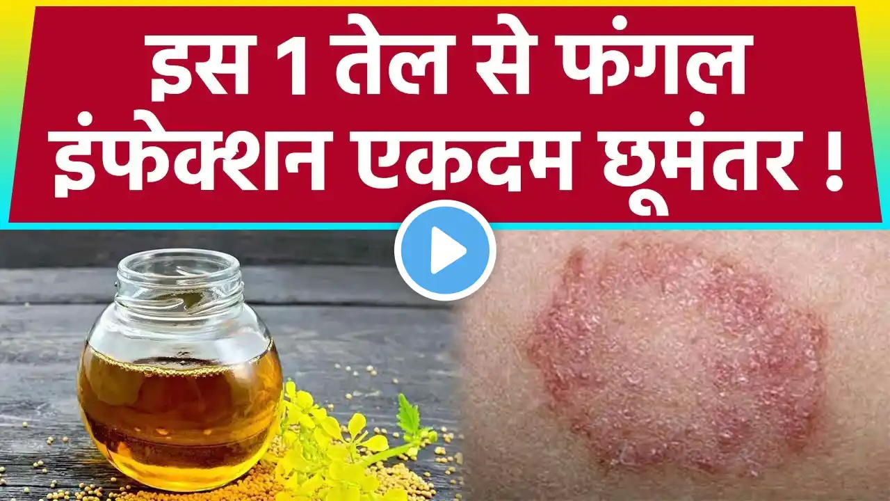 Mustard Oil से क्या ठीक हो सकता है Fungal Infection ? | सरसों के तेल के फायदे | Boldsky