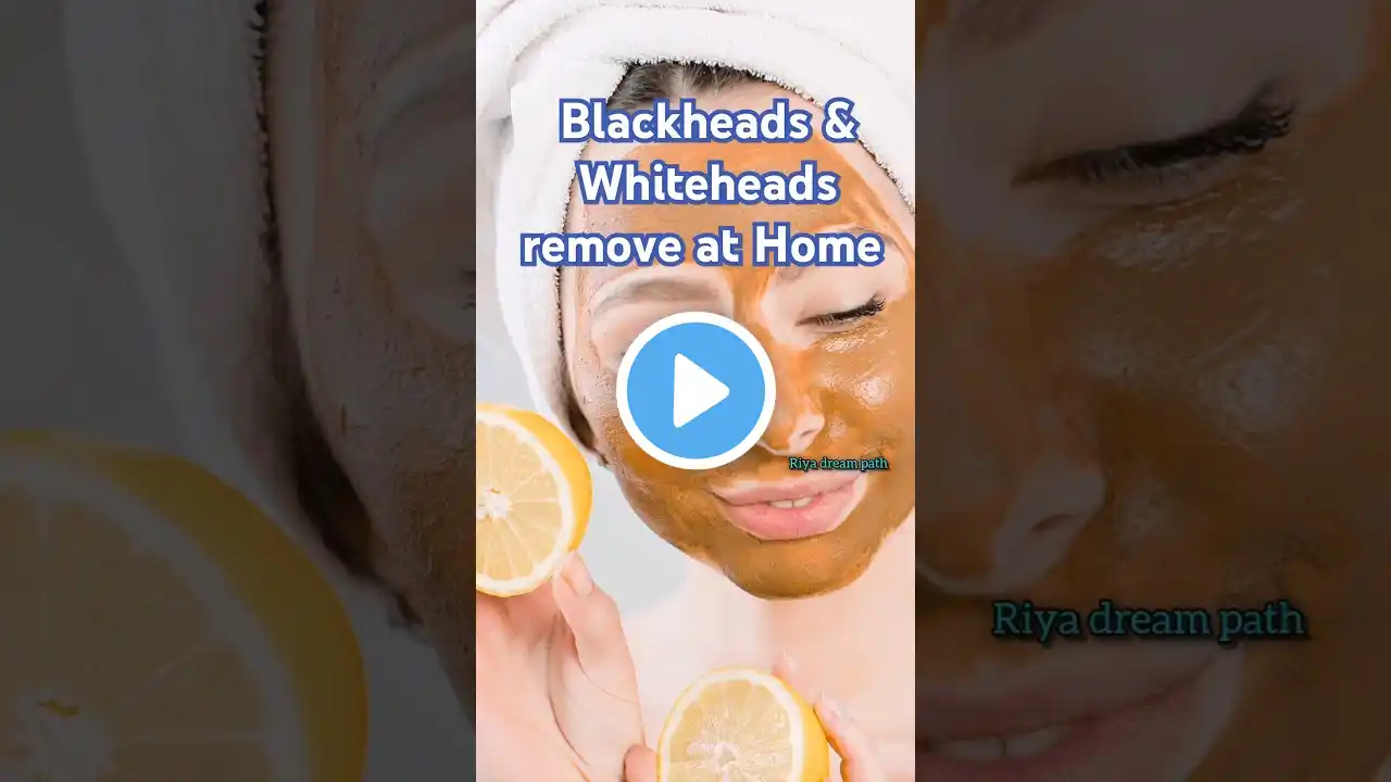 Blackheads & Whiteheads remove #shorts #skincare #beauty #skin #riyadreampath #trending #youtube #yt