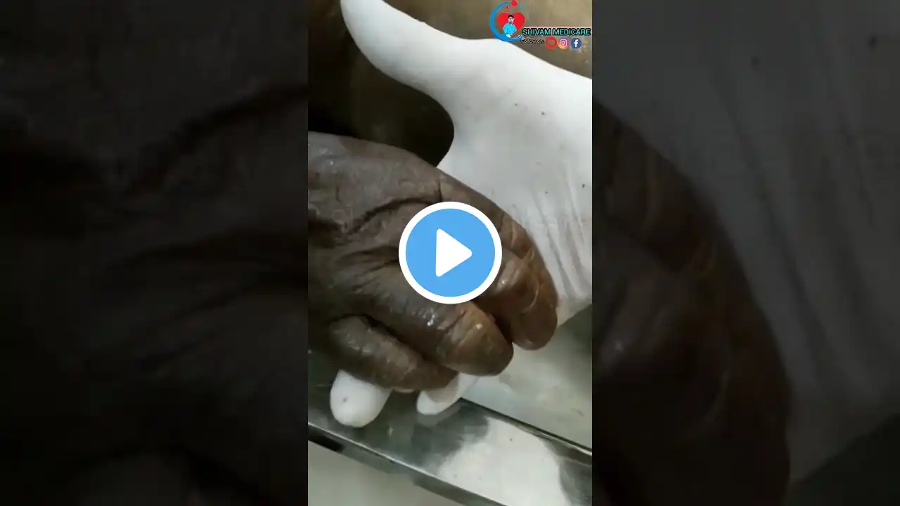 Handshake With CadaverЁЯТА#viral #shorts #facts #trending #viralvideo #shocking #ytshorts #youtube #yt