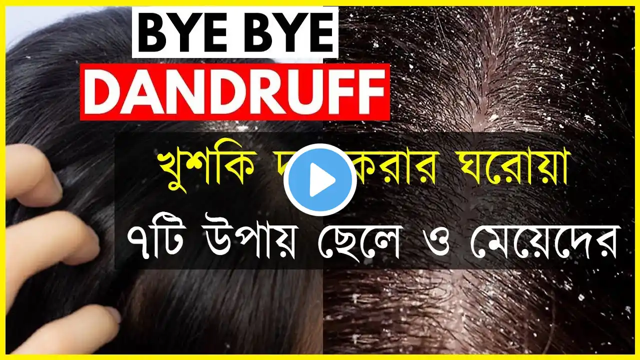 খুশকি দূর করার ঘরোয়া ৭টি উপায় ছেলে ও মেয়েদের । Khuski Dur Korar Hair Pack । Bye Bye Dandruff