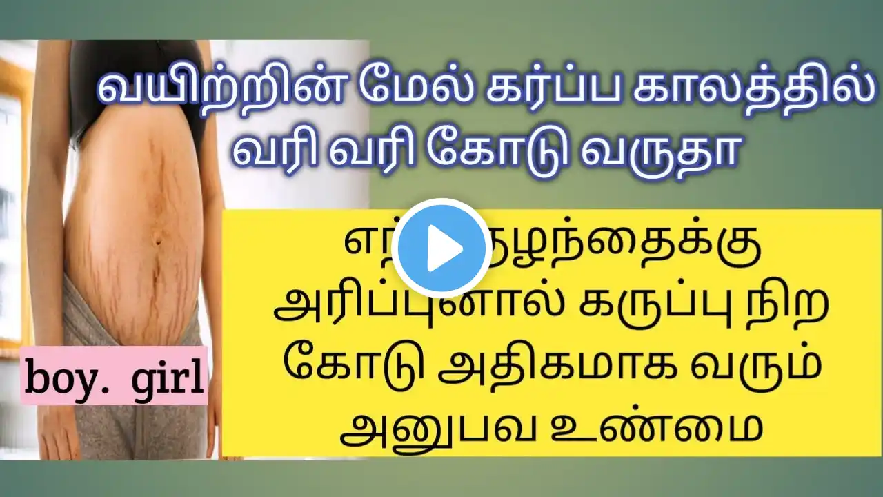 கர்ப்பிணிகள் வயிற்றில் மேல் வரும் கோடு வைத்து ஆண் பெண் குழந்தை என கண்டுபிடிக்கலாம்