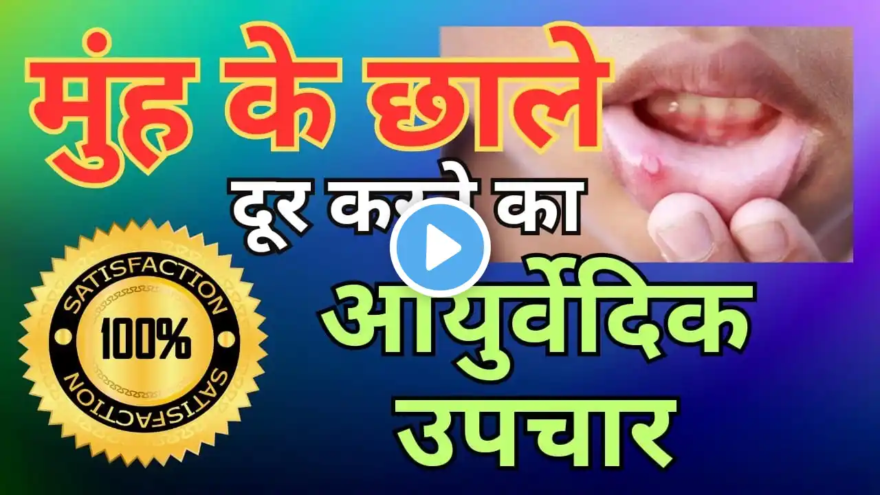 मुंह के छाले (अल्सर ) दूर करने का आयुर्वेदिक उपचार|Ayurvedic treatment to cure mouth ulcers#ulcers