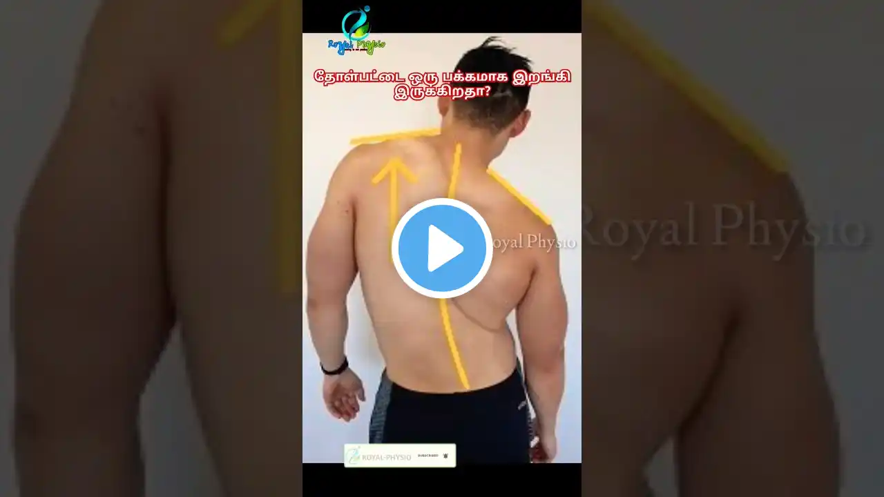 uneven shoulder muscle imbalance tamil | shoulder posture correction tamil | uneven shoulder physio