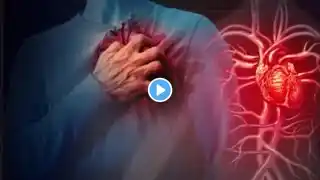 Myocardial Infarction: Heart Attack