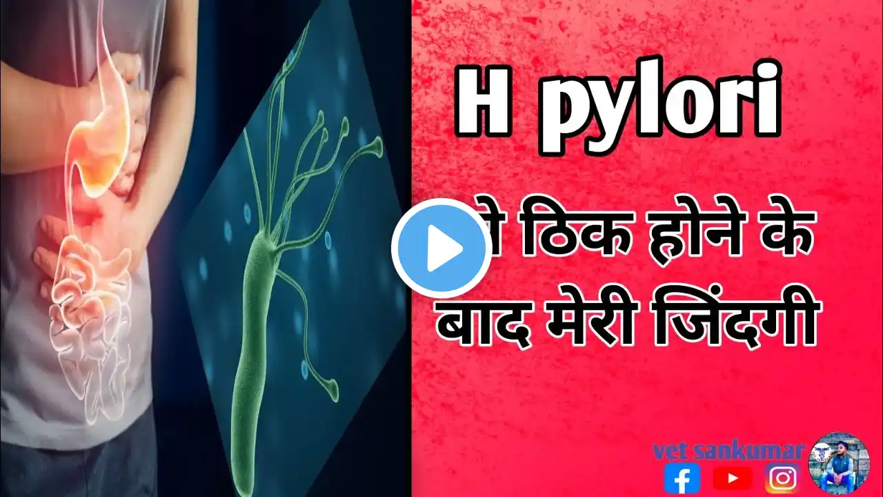 Finally I'm free for h pylori । h Pylori से अब में पूरी तरह से ठिक हु। vet santkumar