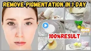 Best Skin Brightening & Pigmentation Removal Treatment